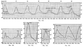 Figs. 109-113—Temperature curves for locations in the montaña, July and August, 1911. The curves are based on hourly readings with interpolated readings for such critical occurrences as the appearance of cloud or rain. Dry bulb readings are shown by solid lines, wet bulb by dotted lines, and breaks in the continuity of the observations by heavy broken lines. Fig. 109 is for Pongo de Mainique, August 20 and 21; Fig. 110 for Yavero; Fig. 111 for Santo Anato, August 11 and 12; Fig. 112 for Sahuayaco, August 20, and Fig. 113 for Santa Ana, July 30 to August 1.